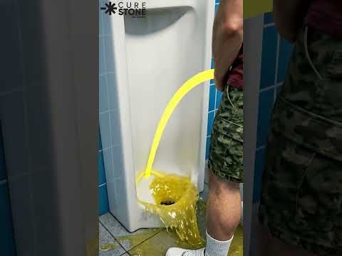 99% Of Men Urinate WRONG! The Urologist’s Secret To ZERO Splashes 🛑