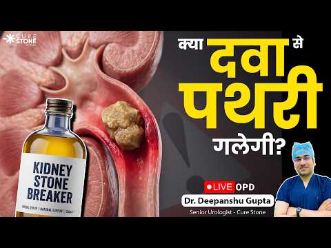 Can Medicine Dissolve Kidney Stones? (क्या दवा से पथरी गल सकती है?) Live OPD by Dr. Deepanshu Gupta