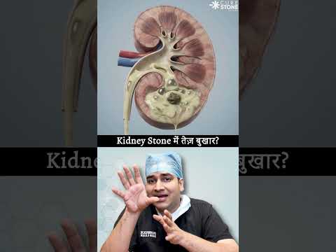 How kidney stones cause fever #urology
