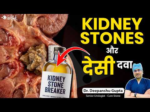Kidney Stone और Desi Dawai का सच | Can Herbal Medicine Dissolve Kidney Stones? | Dr. Deepanshu Gupta