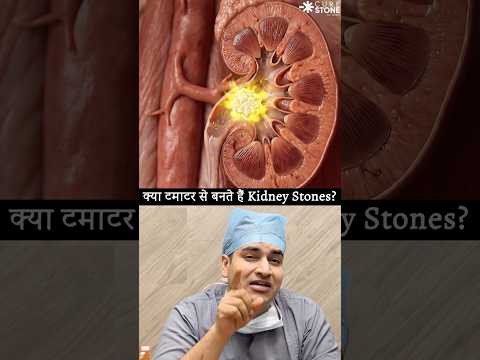 Can we eat tomato in kidney stone disease #urology