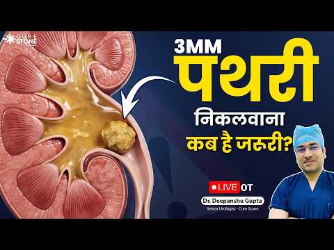 Merchant Navy Medical Test: 3mm Kidney Stone Laser Surgery | 10 मिनट में पथरी से छुटकारा -Cure Stone