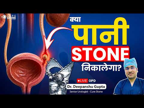 Best Time to Drink Water for Kidney Stones | गुर्दे की पथरी का सच | How much Water to Drink? 💦✔️