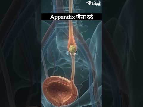 पथरी का दर्द कहाँ होता है? Kidney stone pain location in Hindi