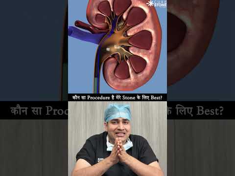 Which is best procedure for kidney stones treatment #urology