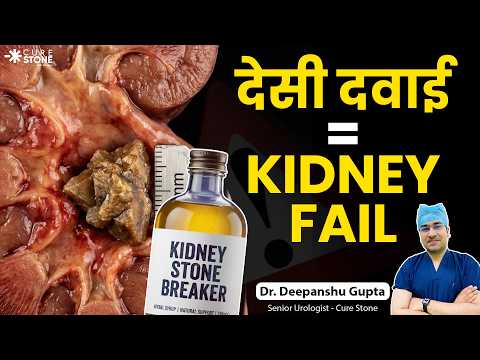 Desi Dawai for Kidney Stone? 15mm पथरी की सच्चाई और सही इलाज | Dr. Deepanshu Gupta