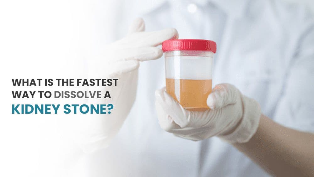 What is the fastest way to dissolve a kidney stone?