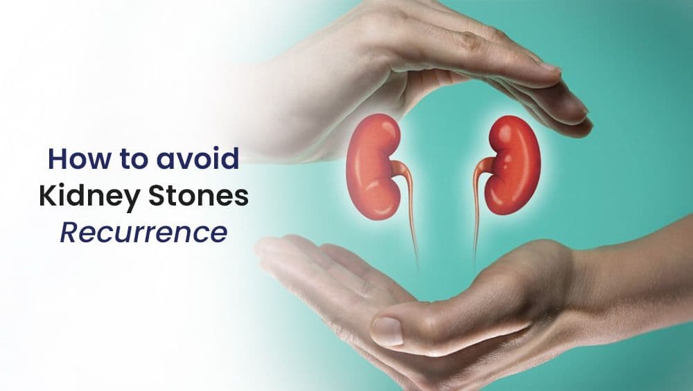 How To Avoid Kidney Stones Recurrence?