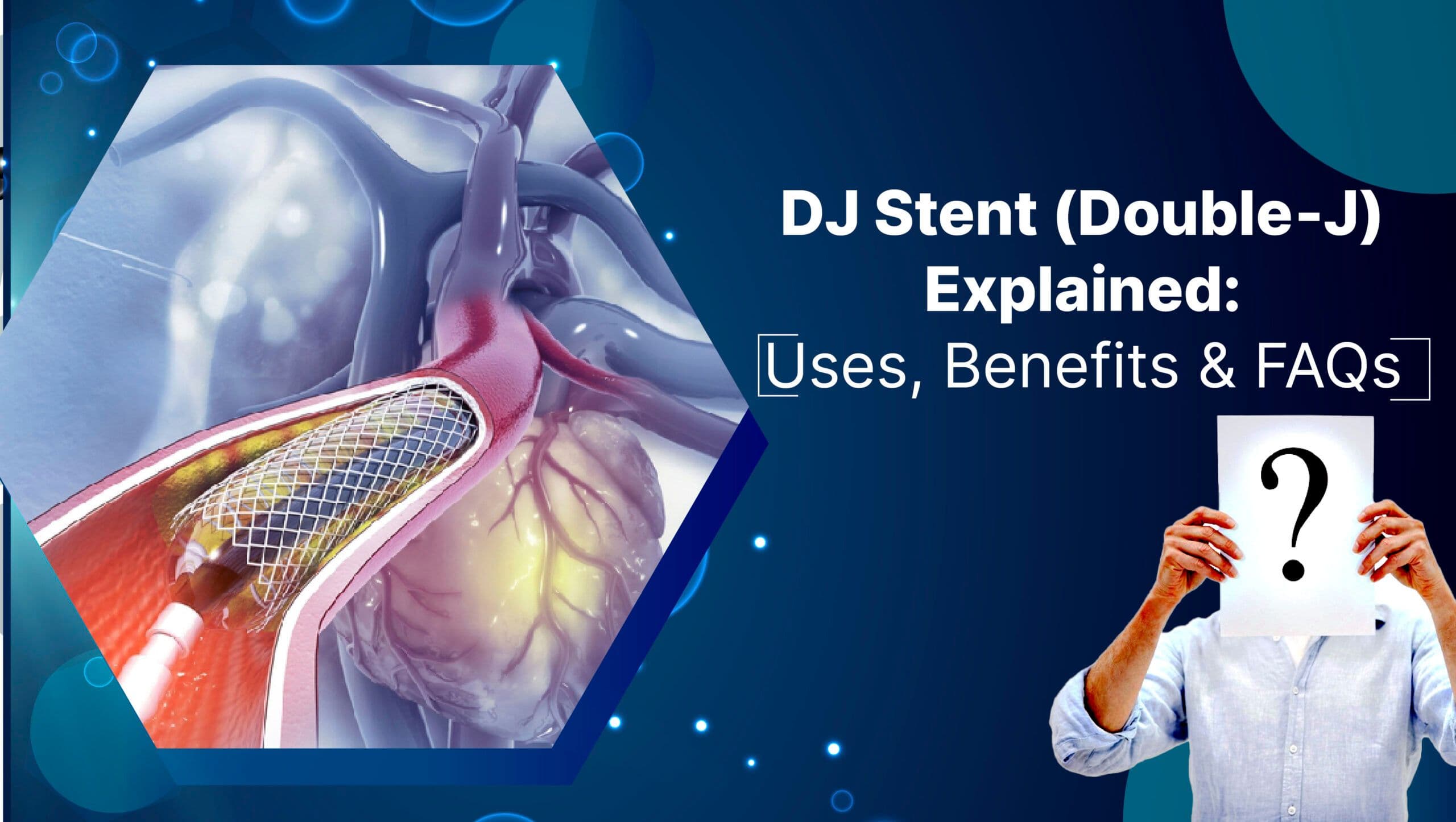 DJ Stent (Double‑J) Explained: Uses, Benefits & FAQs