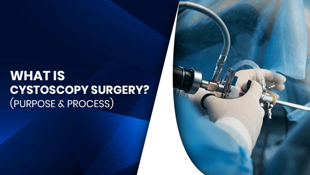 What Is Cystoscopy Surgery? (Purpose & process)
