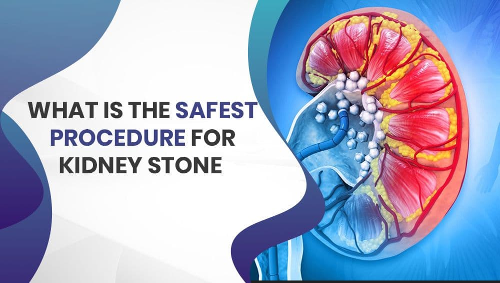 What is the safest procedure for a kidney stone?