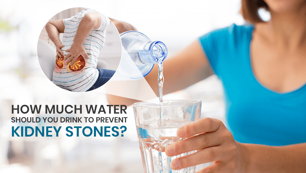 How much water should you drink to prevent kidney stones?