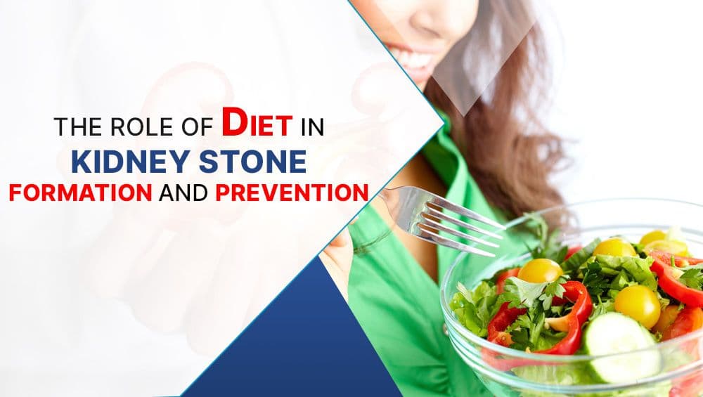 The Role of Diet in Kidney Stone Formation & Prevention