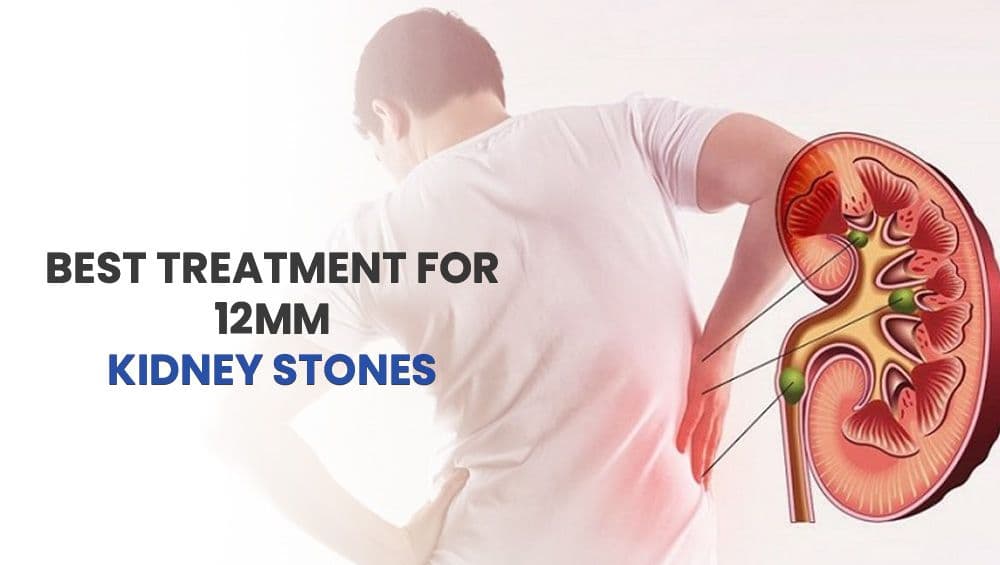 Best Treatment For 12mm Kidney Stones