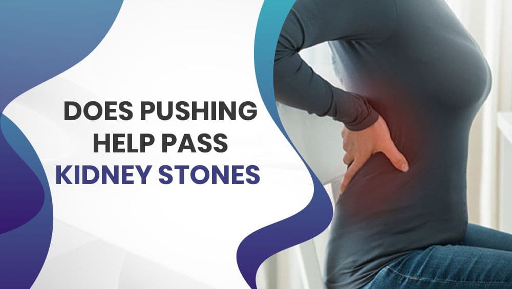 Does pushing help pass kidney stones