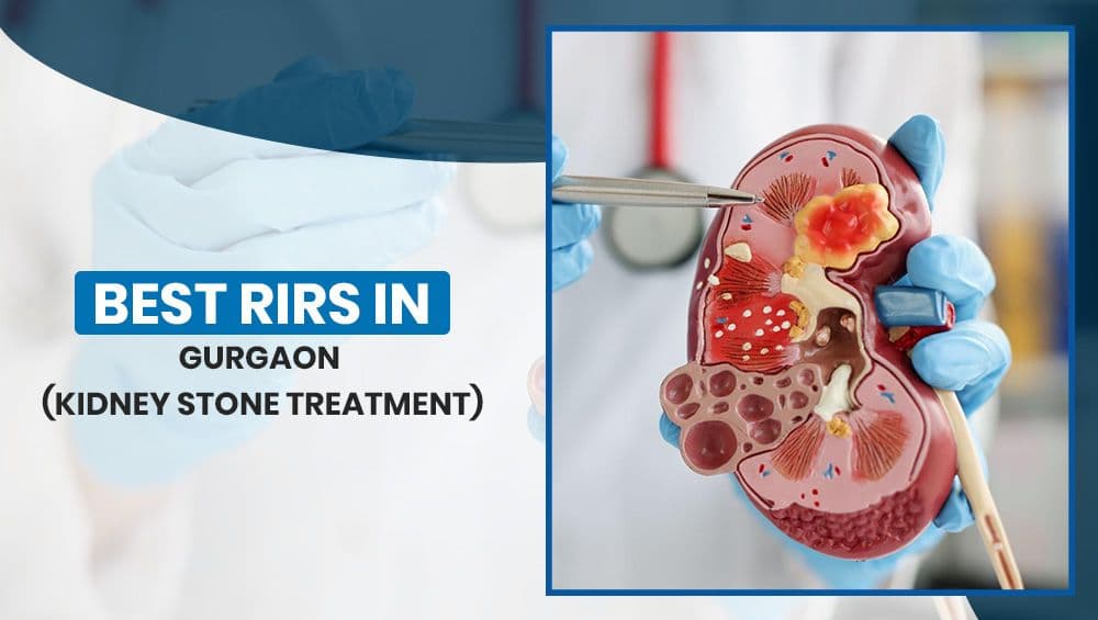 Best RIRS in Gurgaon – Kidney Stone Treatment