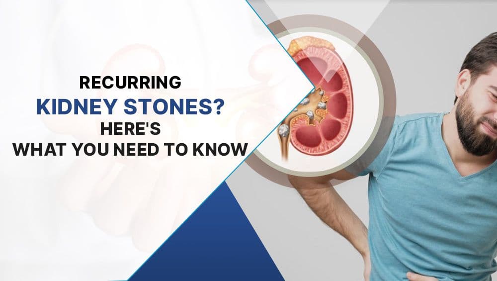 Recurring Kidney Stones? Here’s What You Need to Know