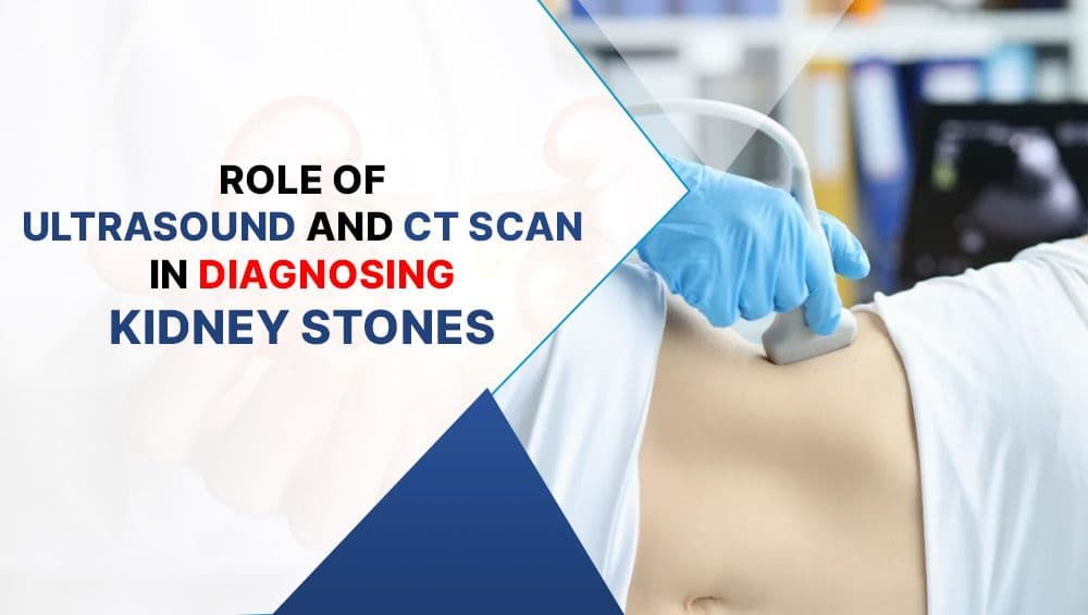 Role of Ultrasound & CT Scan in Diagnosing Kidney Stones