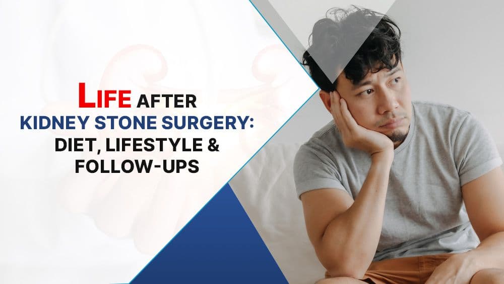 Life After Kidney Stone Surgery: Diet, Lifestyle & Follow-ups