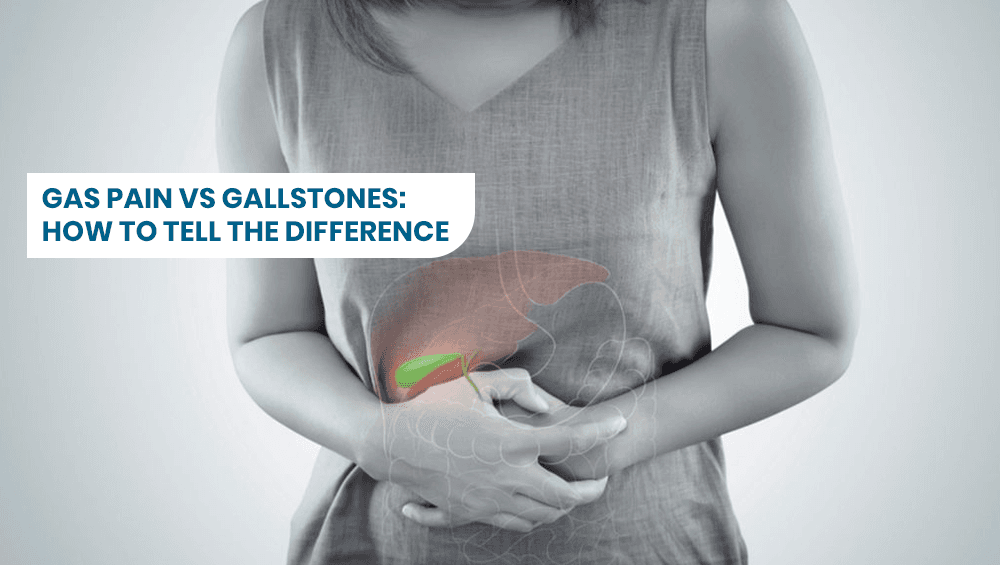 Gas Pain vs Gallstones: How to Tell the Difference