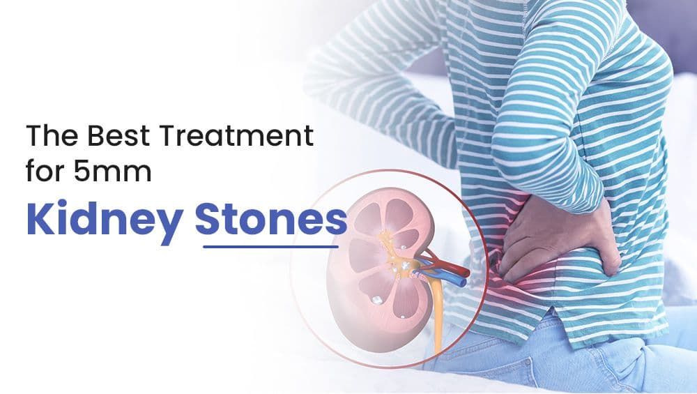 The Best Treatment for 5mm Kidney Stones