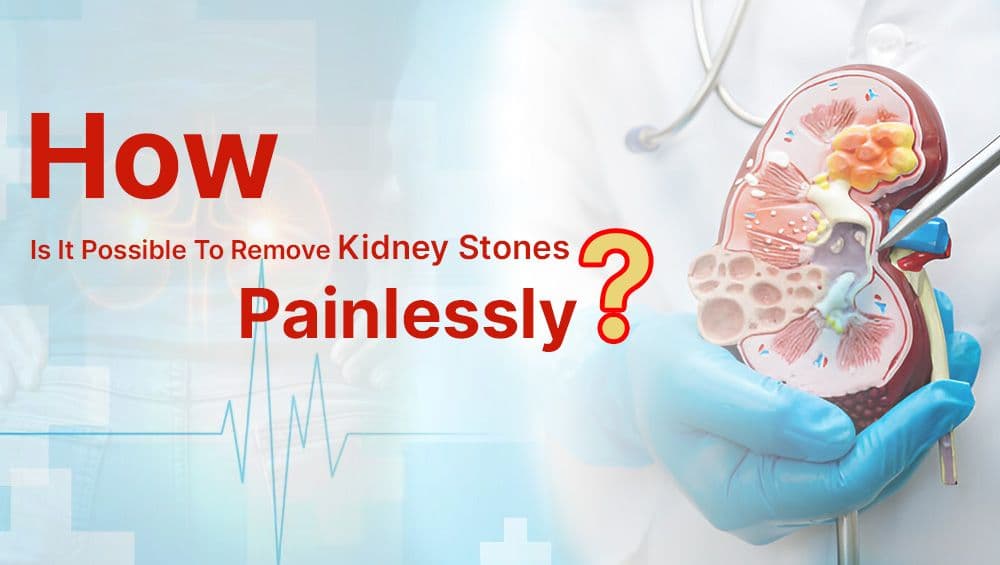 How Is It Possible To Remove Kidney Stones Painlessly?