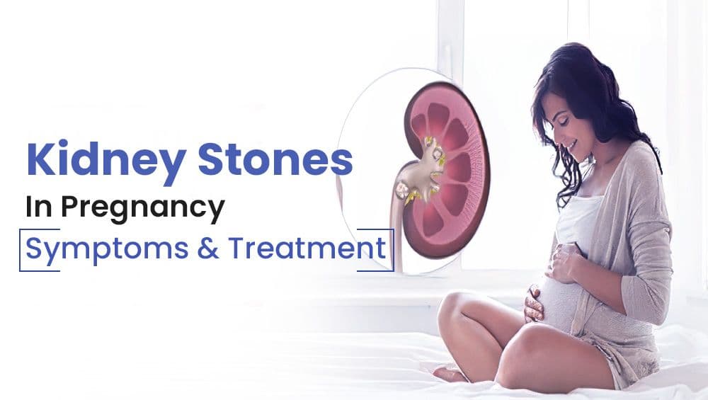 Kidney Stones In Pregnancy: Symptoms & Treatment
