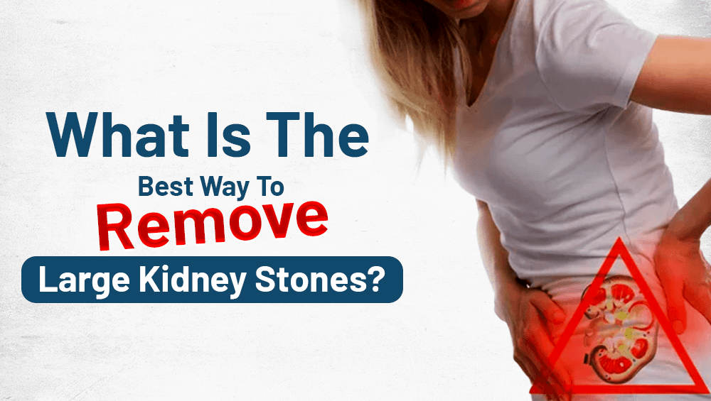 What Is The Best Way To Remove Large Kidney Stones?