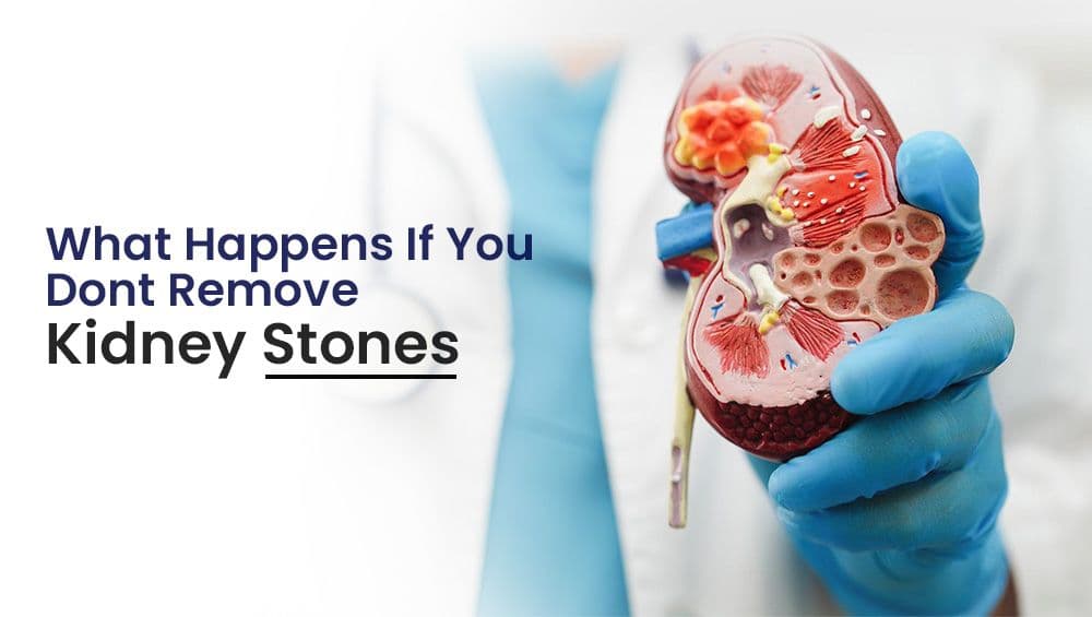 What happens if you don’t remove kidney stones?