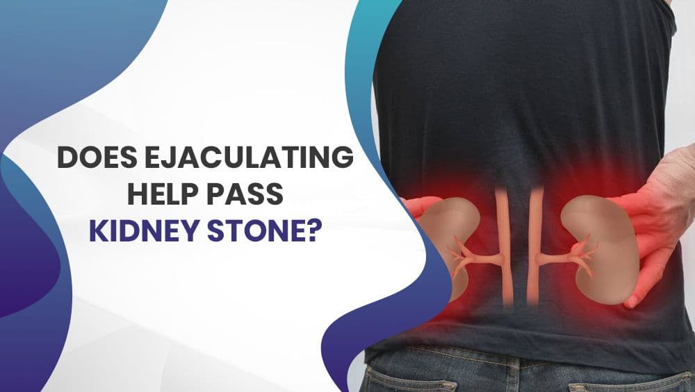 Does ejaculating help pass kidney stones?