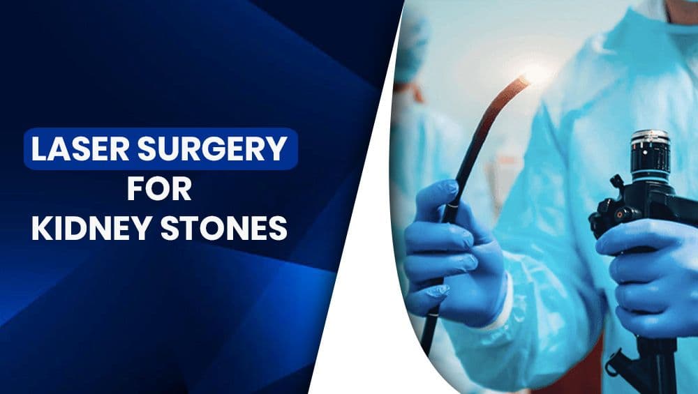 Laser Surgery For Kidney Stones