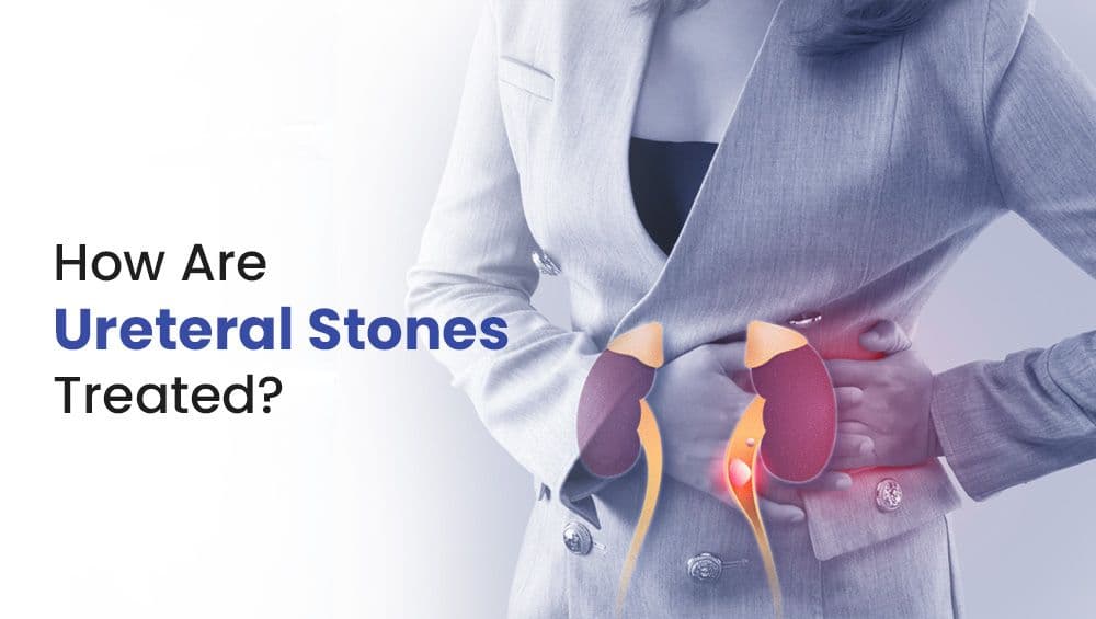 How Are Ureteral Stones Treated?