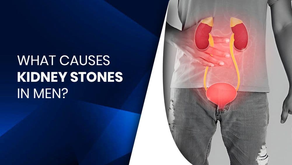 What causes kidney stones in men?