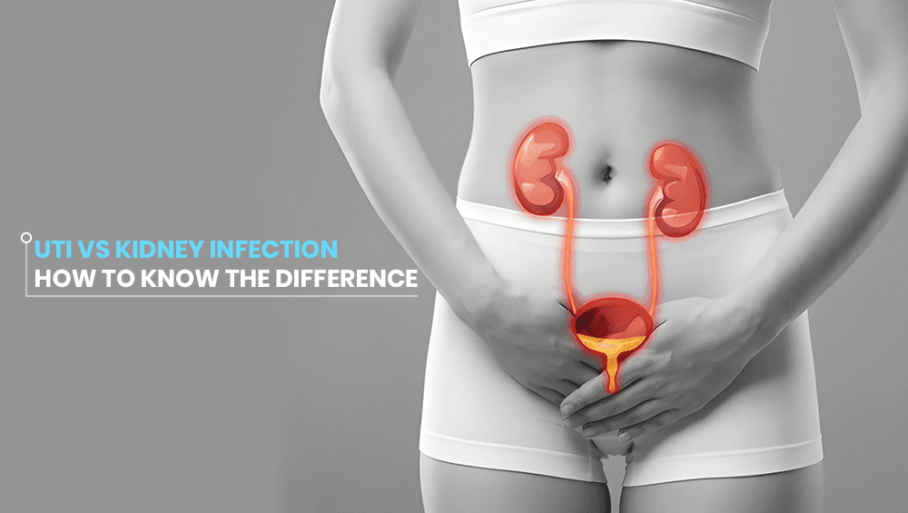 UTI vs Kidney Infection – How to Know the Difference