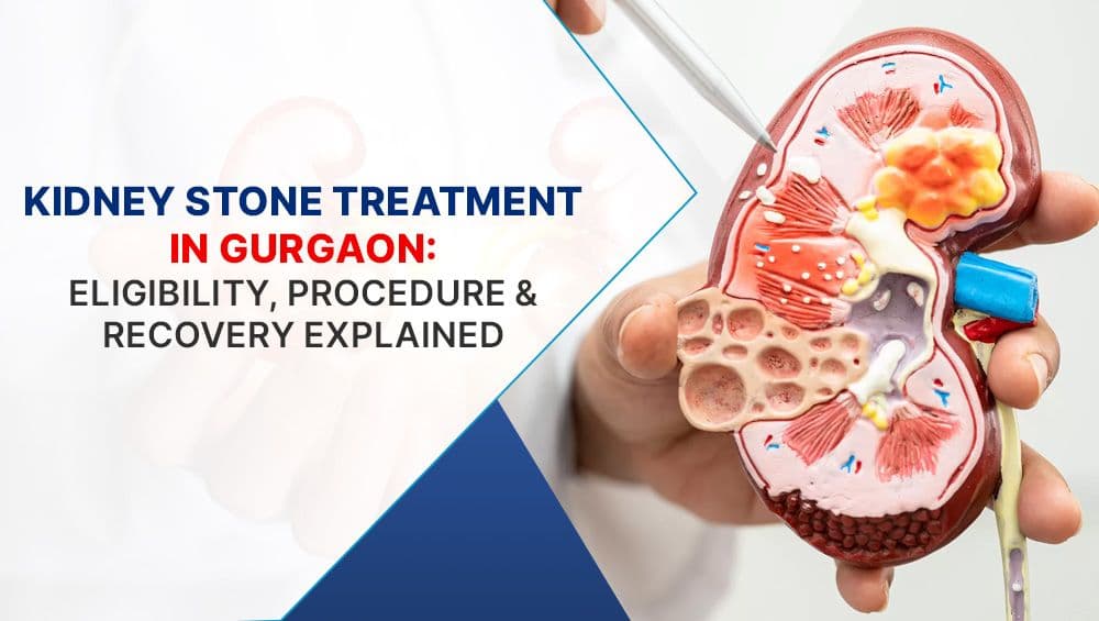 Kidney Stone Treatment in Gurgaon: Eligibility, Procedure & Recovery