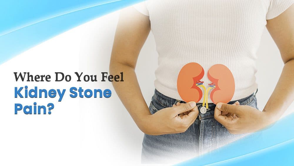 Where Do You Feel Kidney Stone Pain?