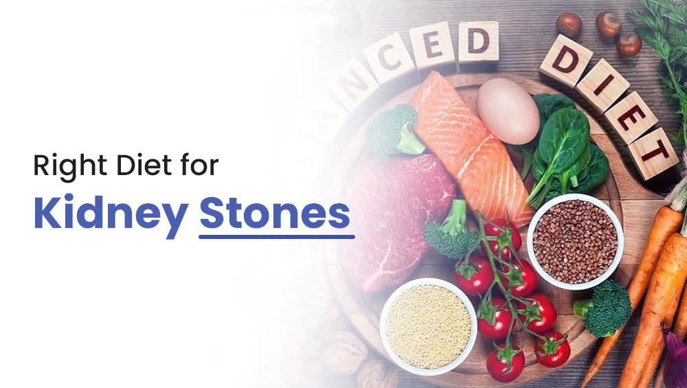 Right Diet for Kidney Stones