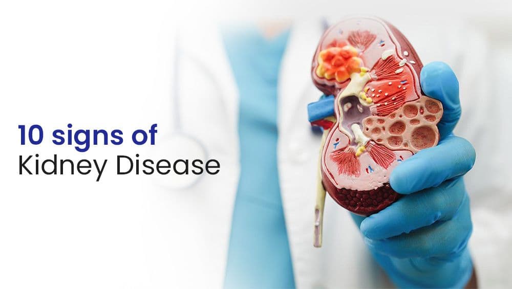 10 Signs Of Chronic Kidney Diseases