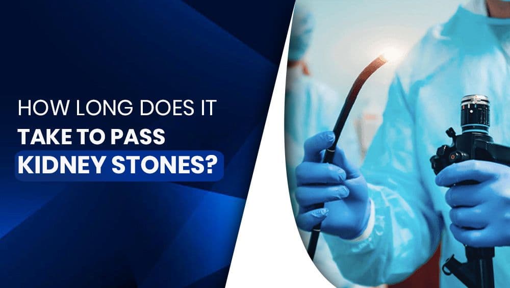 How Long Does It Take to Pass Kidney Stones?