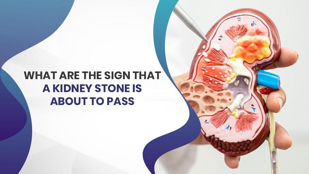 What Are the Signs That a Kidney Stone Is About to Pass?
