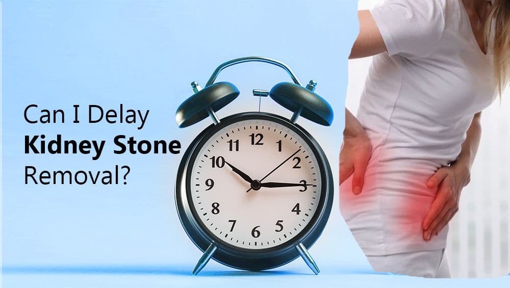 Can I Delay Kidney Stone Removal?