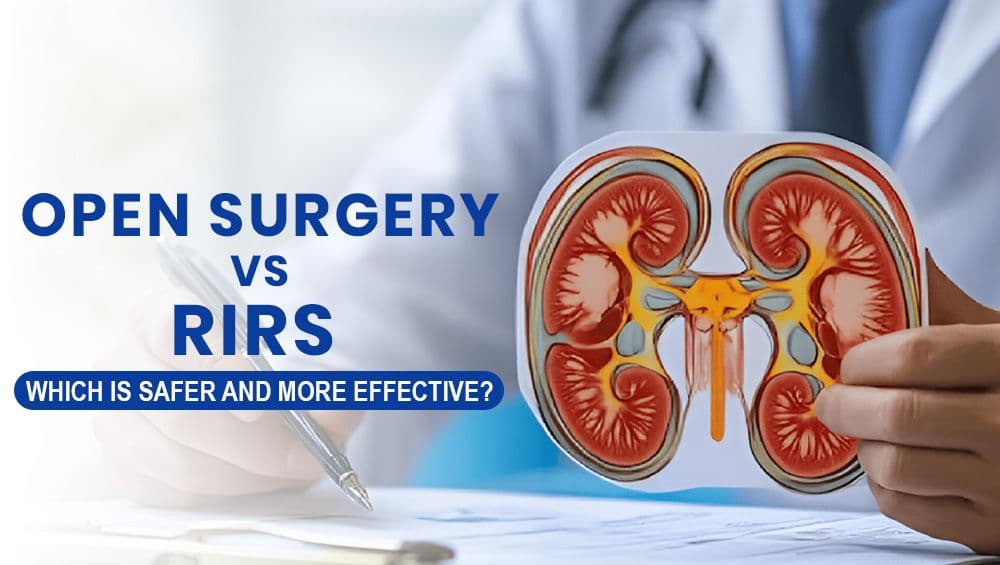 Open Surgery vs RIRS – Which Is Safer and More Effective?
