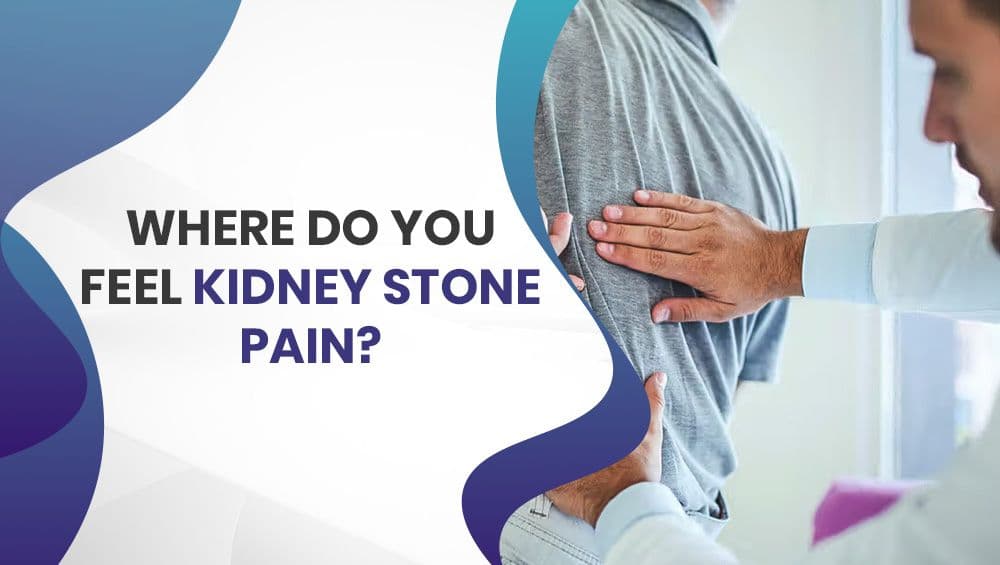 Where do you feel kidney stone pain?