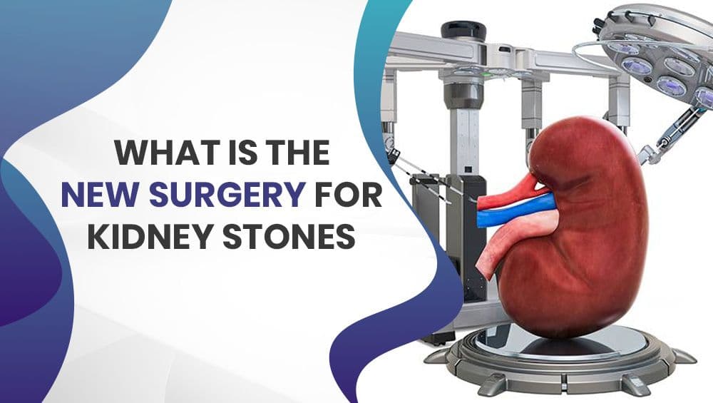 What is the New Surgery for Kidney Stones?