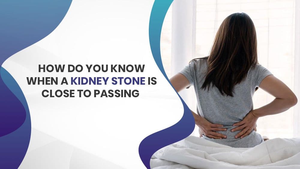 How do you know when a kidney stone is close to passing?