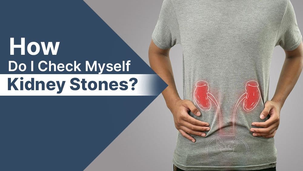 How Do I Check Myself for Kidney Stones?