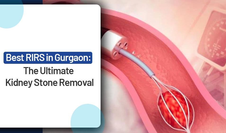 Best RIRS in Gurgaon: The Ultimate Kidney Stone Removal