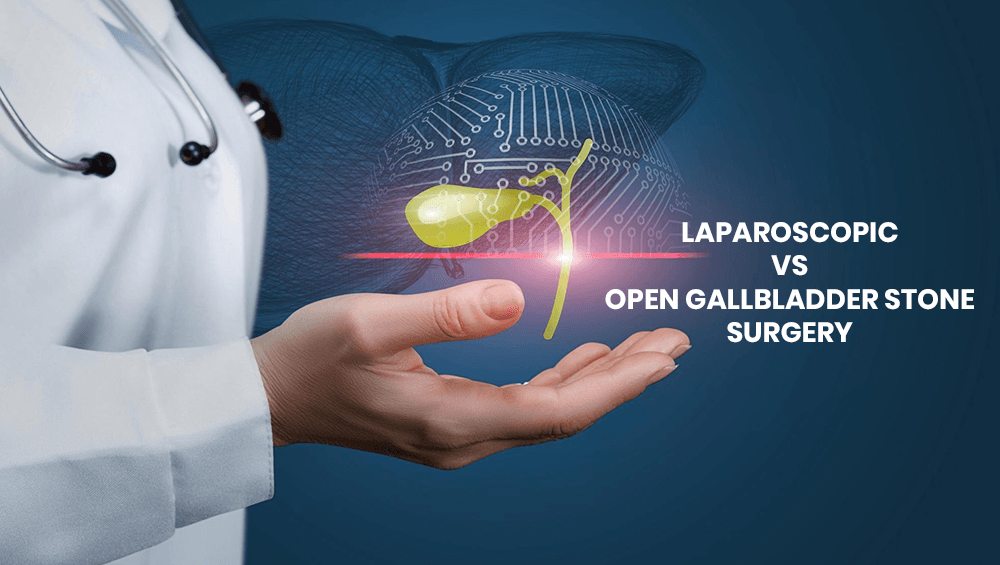 Laparoscopic vs Open Gallbladder Stone Surgery
