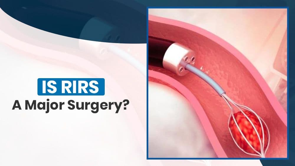 Is RIRS a Major Surgery?