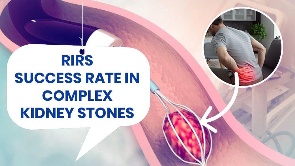 RIRS Success Rate in Complex Kidney Stones
